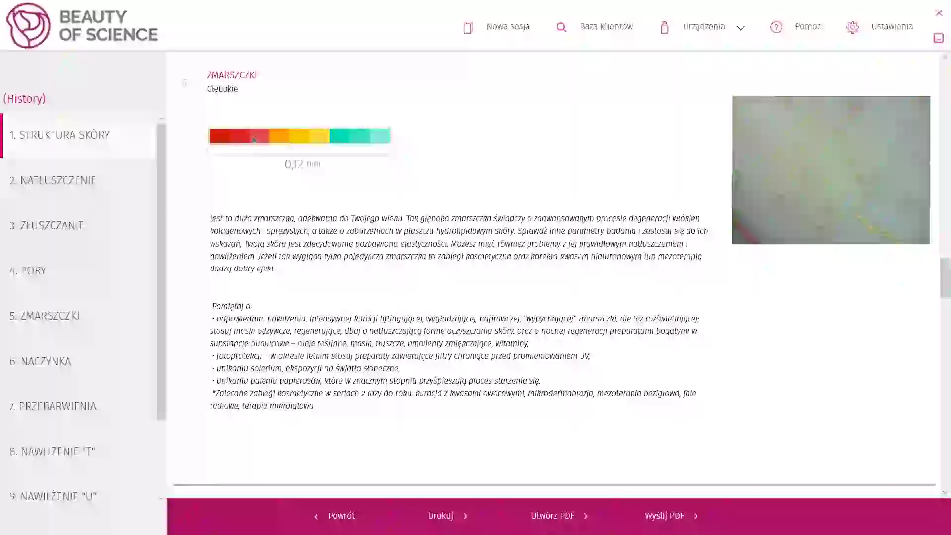 Raport na temat zmarszczek wraz z wskazówkami